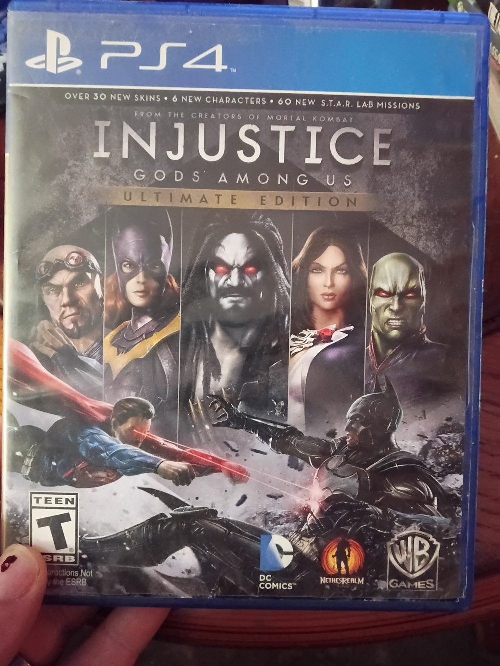 Sony PS4 Injustice: Gods Among Us Ultimate Edition - Black Cover, Blue Case